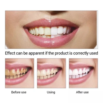 80ml de Albire a Dintilor Lichid Igienă Orală Curățare Scoateți Placa Pata de Lumina de Albire a Dintilor Orale a Dintilor Instrument de Curățare