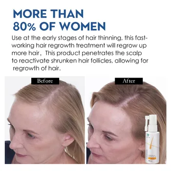 HAIRCUBE Cresterea Parului Ser Spray Tratament de Îngrijire a Părului Produse pentru Cresterea Parului Ulei Organic Natural Tonic pentru Păr Produse de Frumusete