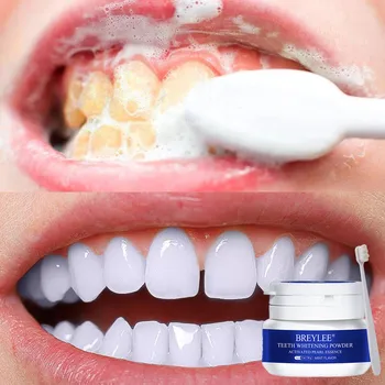 BREYLEE Albirea Dintilor Praf Elimina Placa Petele de Pasta de dinti Instrumente Dentare Dinți Albi de Curățare Igienă Orală Periuta de dinti 30-55g