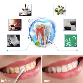 80ml de Albire a Dintilor Lichid Igienă Orală Curățare Scoateți Placa Pata de Lumina de Albire a Dintilor Orale a Dintilor Instrument de Curățare