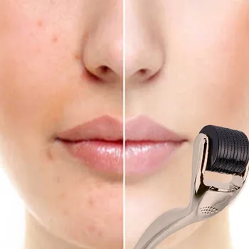 Masaj Facial Cu Role De 540 Micro Terapia Cu Ace Cu Role Derma Titan Facial Exfoliant Instrument Skin Exfoliator Grijă Masaj Facial