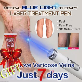 1 buc Medicale Portabile Lumină Albastră Terapie Acnee cu Laser Pen Pete pe Piele Îndepărtarea Pen Anti Varicoase Venoase Spider Eraser Tratament