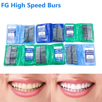 50pcs/pachet TF SERIE Dentare cu Diamant FG de Mare Viteză Freze pentru lustruit Freze Dentare