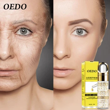 OEDO Aur, Acid Hialuronic Anti-rid de Esență de Hidratare a Hrani Pielea Netedă Ser Micsora Porii Facial Anti-îmbătrânire Esența