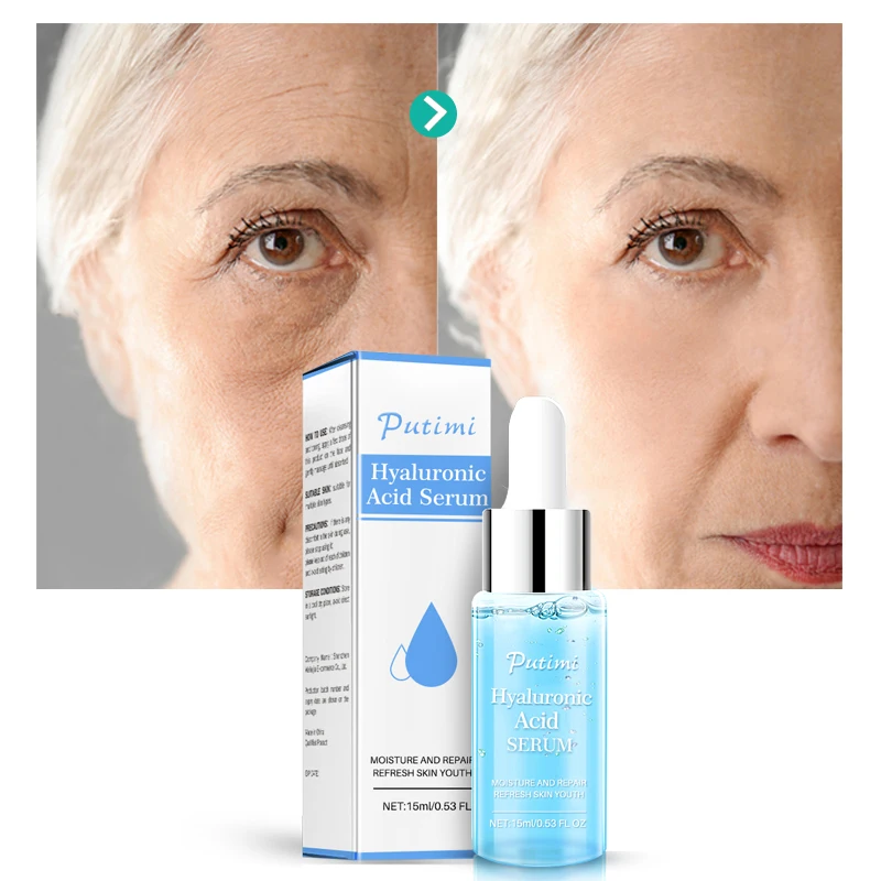 cel mai bun produs de îngrijire a ochilor anti-îmbătrânire dermatita in jurul ochilor
